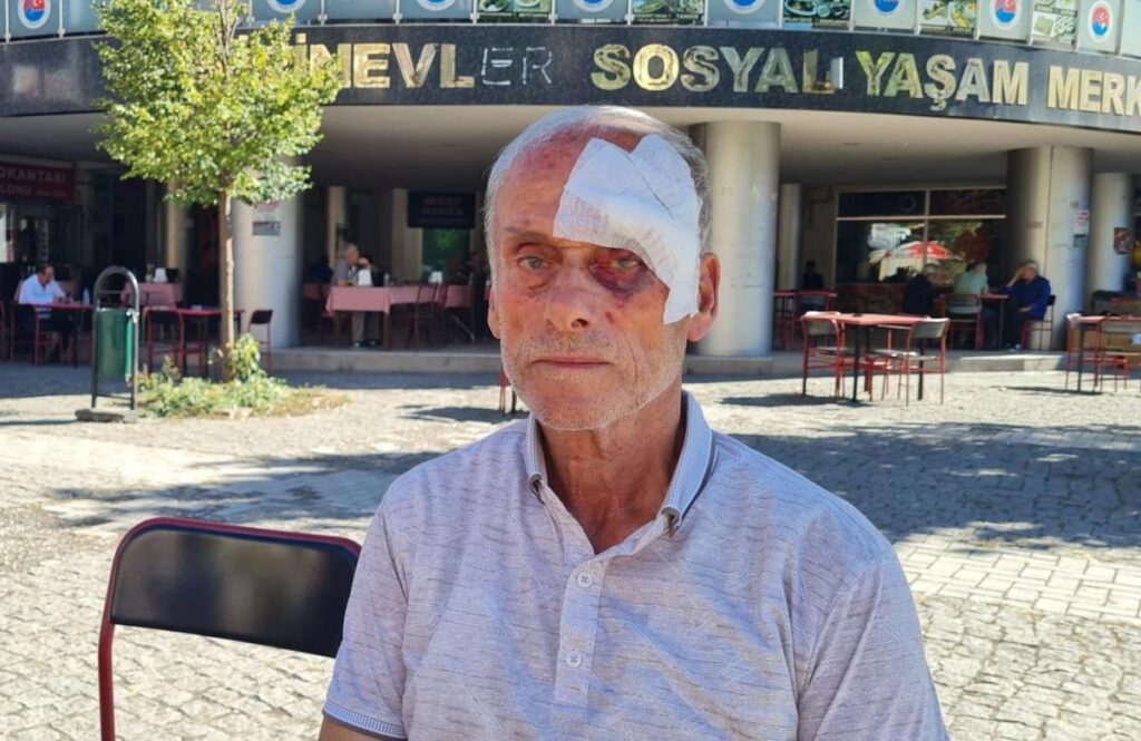 57 yıllık CHP üyesi parti binasında darp edildi