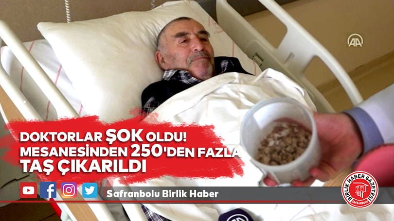 Doktorlar Şok Oldu! Mesanesinden 250’den fazla taş çıkarıldı