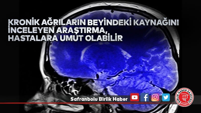 Kronik ağrıların beyindeki kaynağını inceleyen araştırma, hastalara umut olabilir