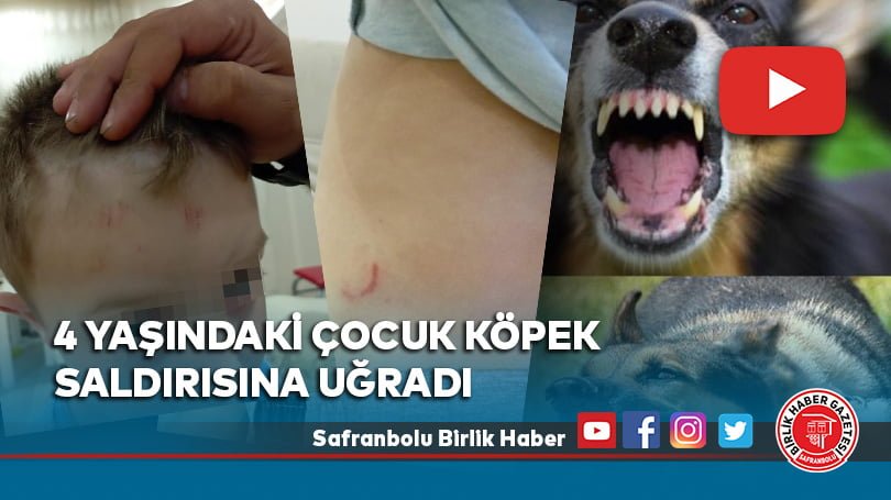 4 yaşındaki çocuk köpek saldırısına uğradı