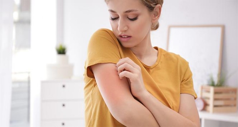 Uyuz salgınında tehlike geçmedi, vakalar artıyor