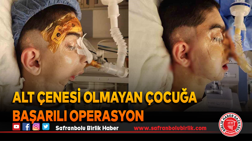 Doğuştan alt çenesi olmayan çocuğa başarılı operasyon