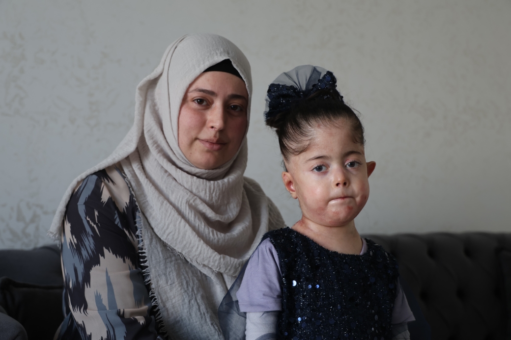 Tek dileği kelebek hastası kızına doyasıya sarılabilmek