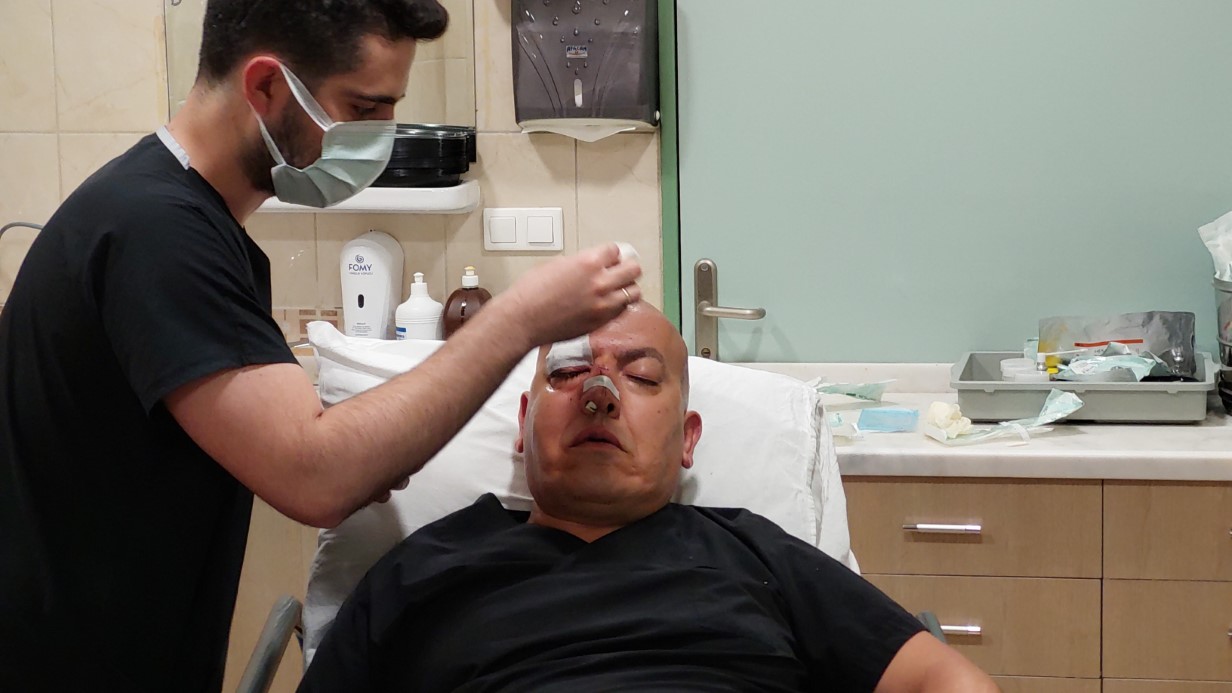 Hasta yakını, yumrukladığı doktorun burnunu kırdı