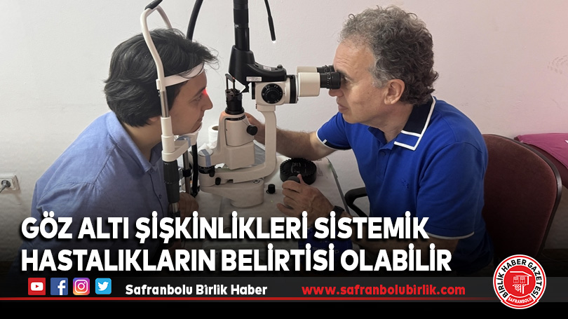 Göz Altı Şişkinlikleri Sistemik Hastalıkların Belirtisi Olabilir