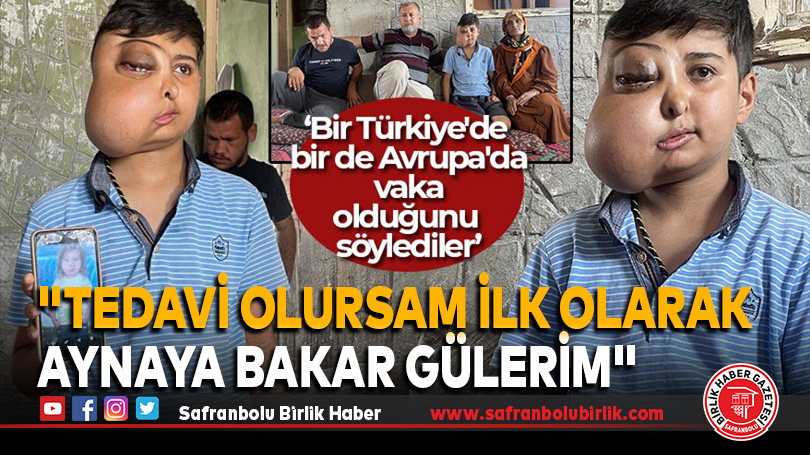 “Tedavi Olursam İlk Olarak Aynaya Bakar Gülerim”