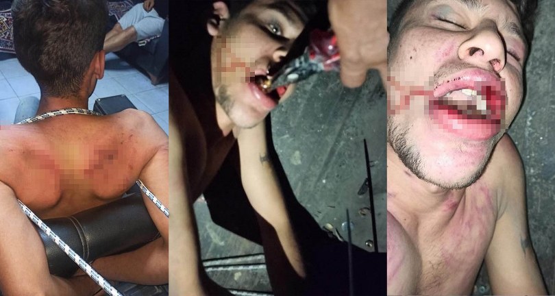 İşkence yapıp böcek yedirdiler, kerpetenle dişlerini söktüler