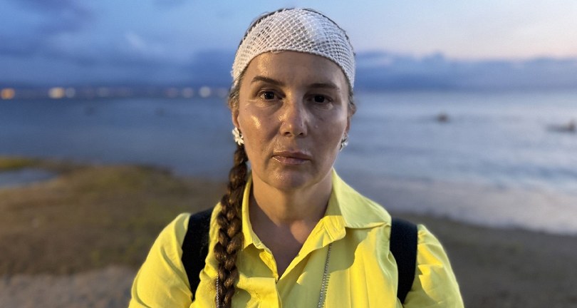 Denizde yüzerken jet ski çarptı, ölümden döndü