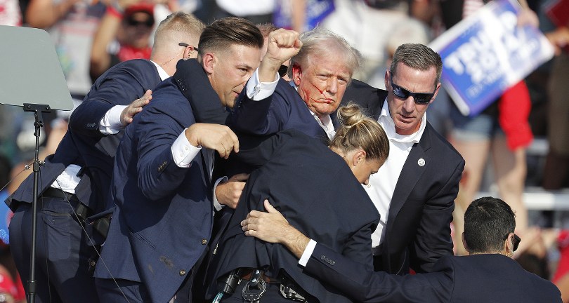 Doktoru Trump’ın kulağına mermi değil şarapnel isabet ettiği iddiasını yalanladı