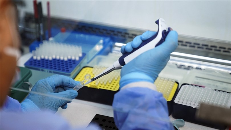 Ankara İl Sağlık Müdürlüğü’nden Maymun Çiçeği Açıklaması