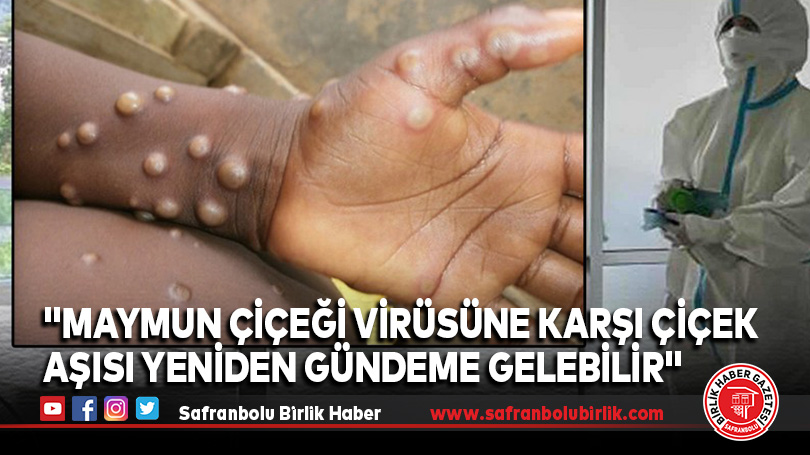 “Maymun Çiçeği Virüsüne Karşı Çiçek Aşısı Yeniden Gündeme Gelebilir”