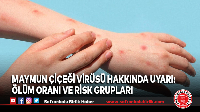 Maymun Çiçeği Virüsü Hakkında Uyarı: Ölüm Oranı ve Risk Grupları