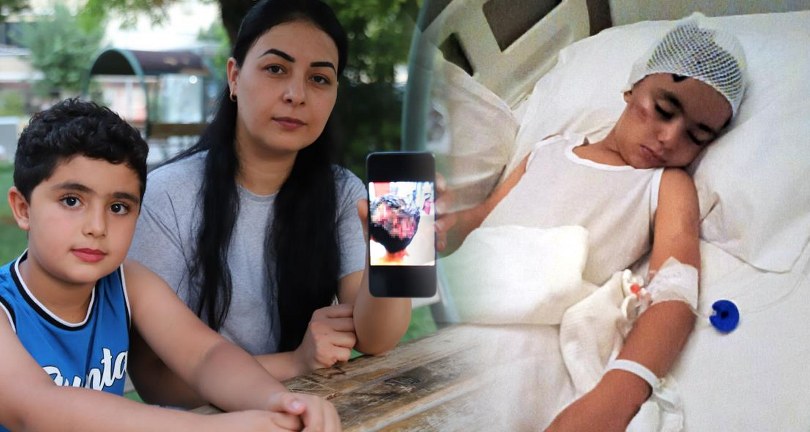 Sokak köpeği saldırısında ağır yaralanan çocuktan ’köpekler toplansın’ çağrısı