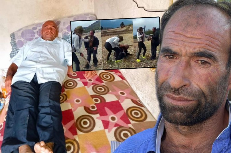 Şiddete maruz kalan çoban Nail’in hayatı yürek burktu