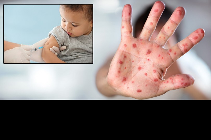 Kızamık ve boğmacaya karşı uzmanlar uyarıyor: “Vakalar artıyor, tedbirleri almak gerekiyor”