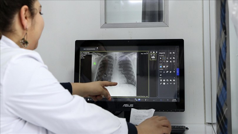 Dünya Sağlık Örgütü: 2023’te 8,2 milyon kişiye tüberküloz teşhisi konuldu