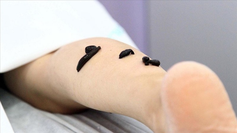 5 bin tıbbi sülüğe el koydu