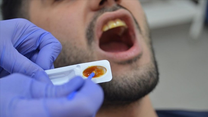 Diş hassasiyeti olanlar için “florsuz vernik” geliştirildi