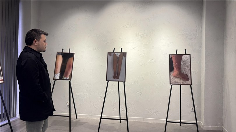 Romatizmal hastalıkların vücuttaki etkileri yapay zeka ile görselleştirildi