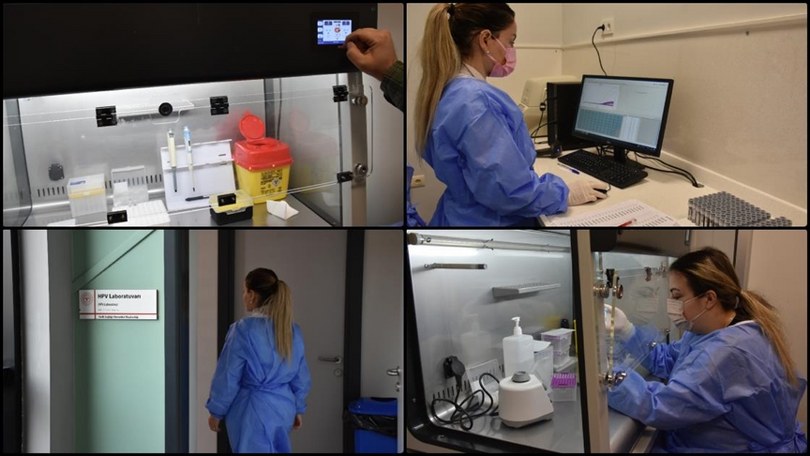 HPV Bölge Laboratuvarında bir ayda 211 kadının kanser riski taşıdığı belirlendi