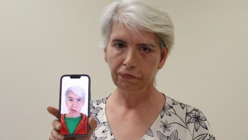 Yüz felci nedeniyle yıllarca açık gözle uyuyan kadın, Eskişehir’de sağlığına kavuştu