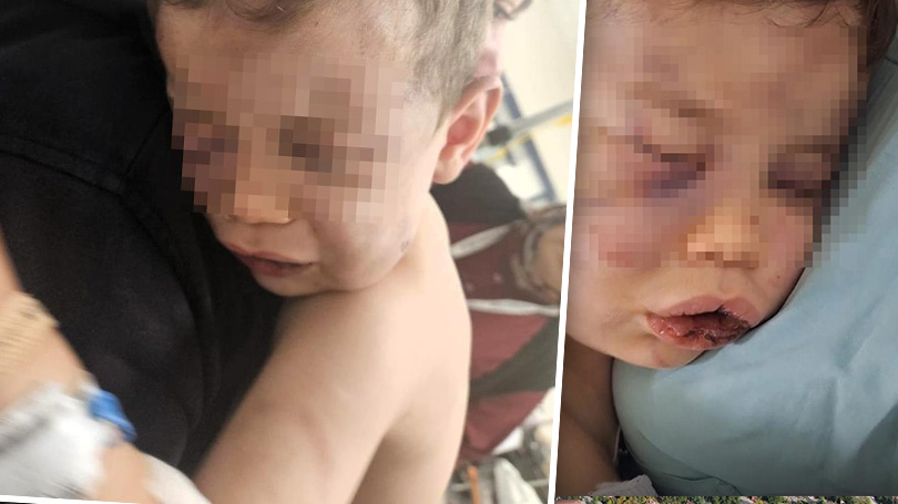 Denizli’de İki Yaşındaki Bebek Şiddet Mağduru: Hayati Tehlikesi Sürüyor