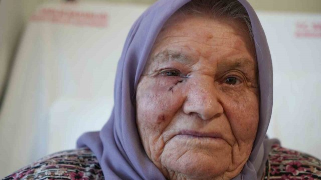 Dört mevsim gözyaşı yağmuru, bir cerrahiyle güneşle buluştu