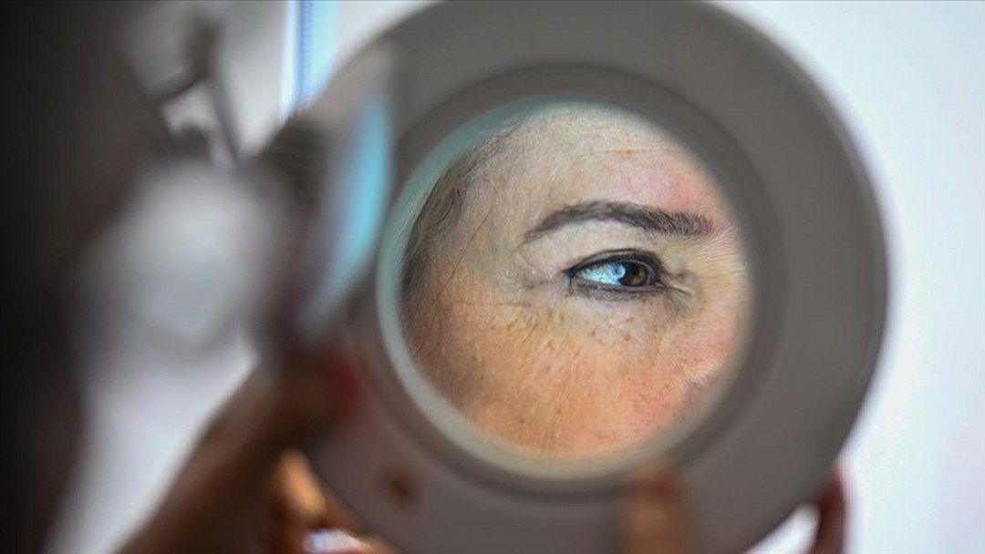 Araştırma: Kanser türlerinden melanom, cinsiyete göre vücudun farklı bölgelerinde yaygın