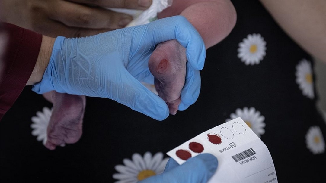 Türkiye’de her 25 kişiden biri fenilketonüri taşıyıcısı