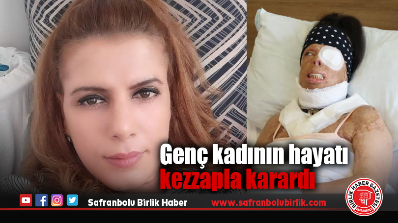 Genç kadının hayatı kezzapla karardı