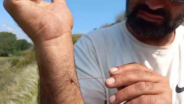 Uzmanı uyardı: “Kenenin vücutta kalma süresi hastalığın bulaşma riskini yükseltiyor”