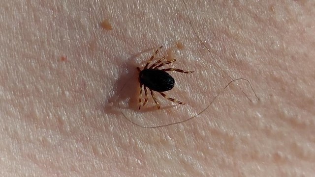 Doğu Karadeniz’de kene mevsimi sakin geçiyor