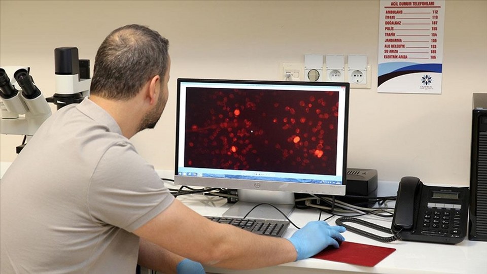 Bilim insanları, Alzheimer hastalığını kan tahliliyle erken teşhis için çalışıyor