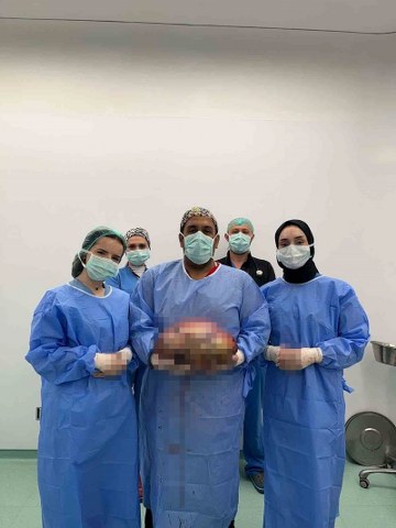 Kadın hastanın karnından 10 kiloluk kitle tespit edildi