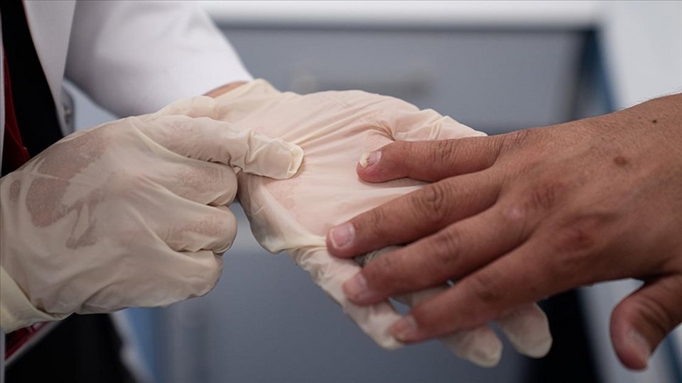 Sedef romatizmasında erken tanı eklem hasarını önlüyor