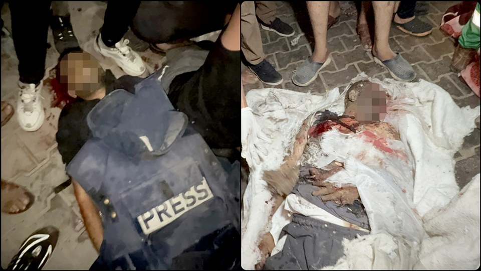 İsrail’in, Şifa Hastanesi yakınlarında gazetecilerin çadırına düzenlediği saldırıda 5 gazeteci hayatını kaybetti