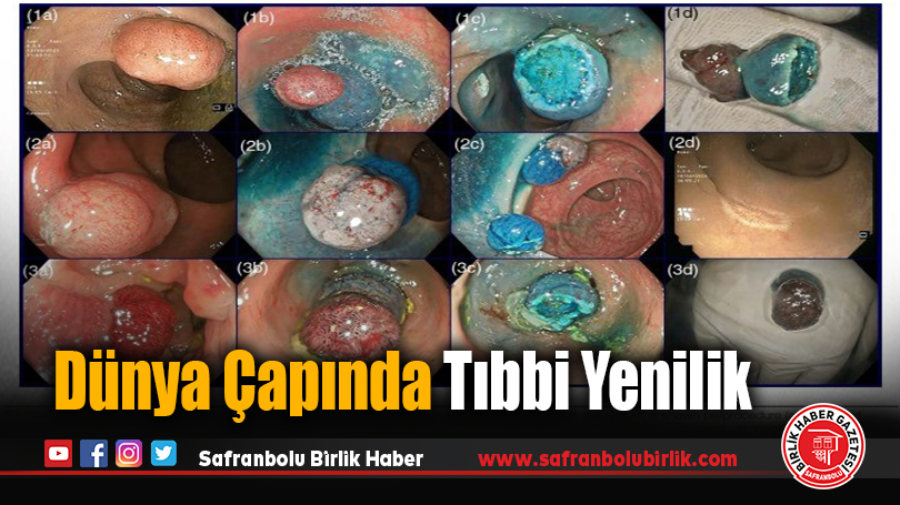 Türk bilim adamının yeni yöntemi uluslararası tıp camiasında kabul gördü