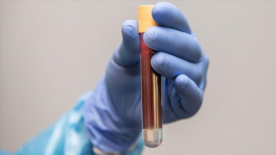 Prostat kanserinde erken teşhis hayat kurtarıyor