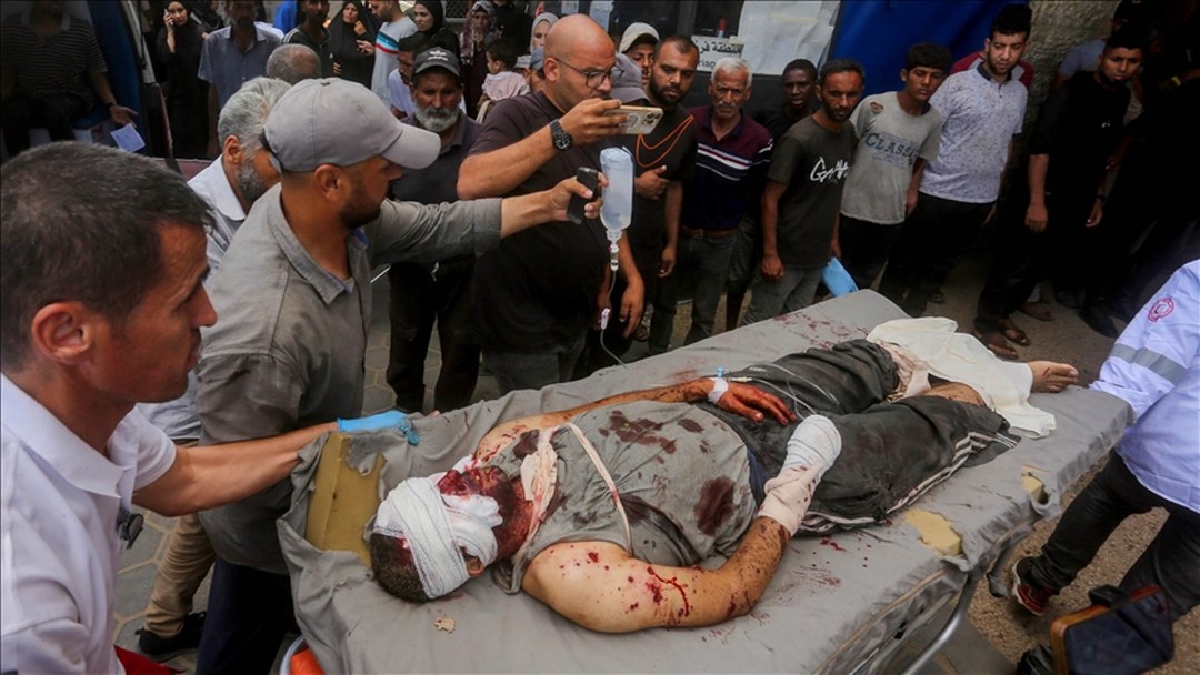 DSÖ, Gazze’de 42 bin kişinin “hayat değiştiren” yaralanmaya maruz kaldığını bildirdi