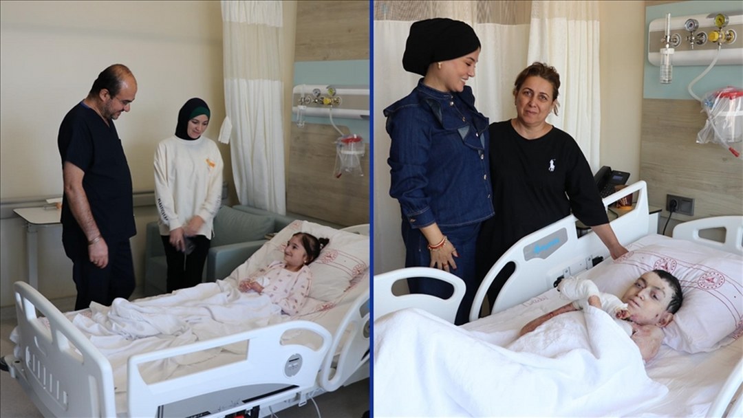 Azerbaycanlı iki kelebek hastasının yaşamı Kütahya Şehir Hastanesindeki ameliyatla kolaylaştı