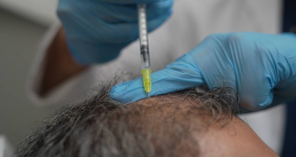 Dökülen saçlar vücudun bir alarmı olabilir