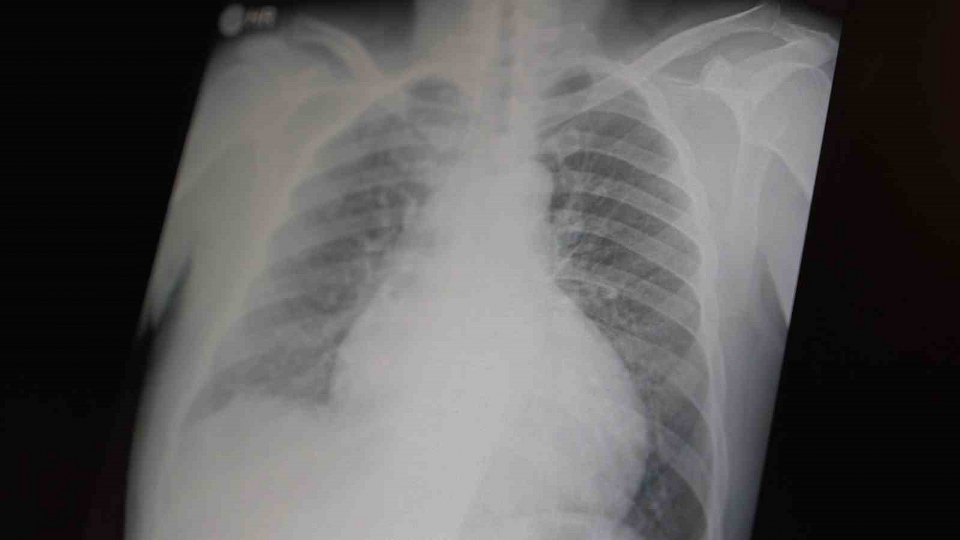 Profesör açıkladı: “Metamfetamin ve kokain gençler arasında tehlikeli boyutlara ulaştı”