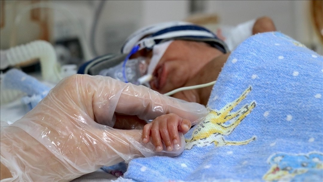 Prematüre bebeklerde multidisipliner takip yaşam kalitesini artırabiliyor