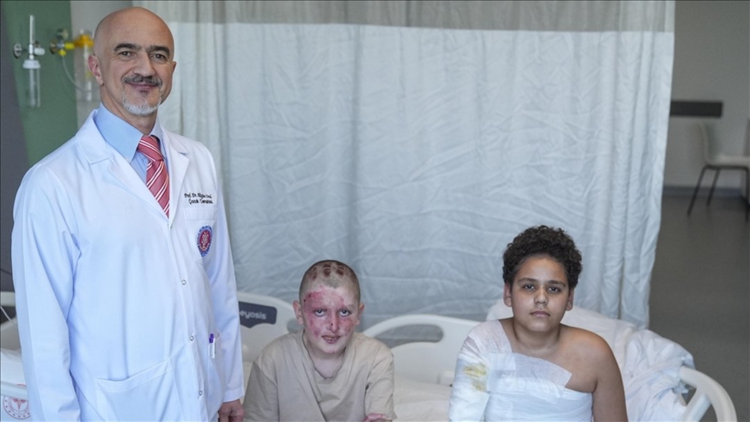 Vücutlarının yüzde 40’ında yanık oluşan çocuklar yaralarını arkadaşlıkla sardı