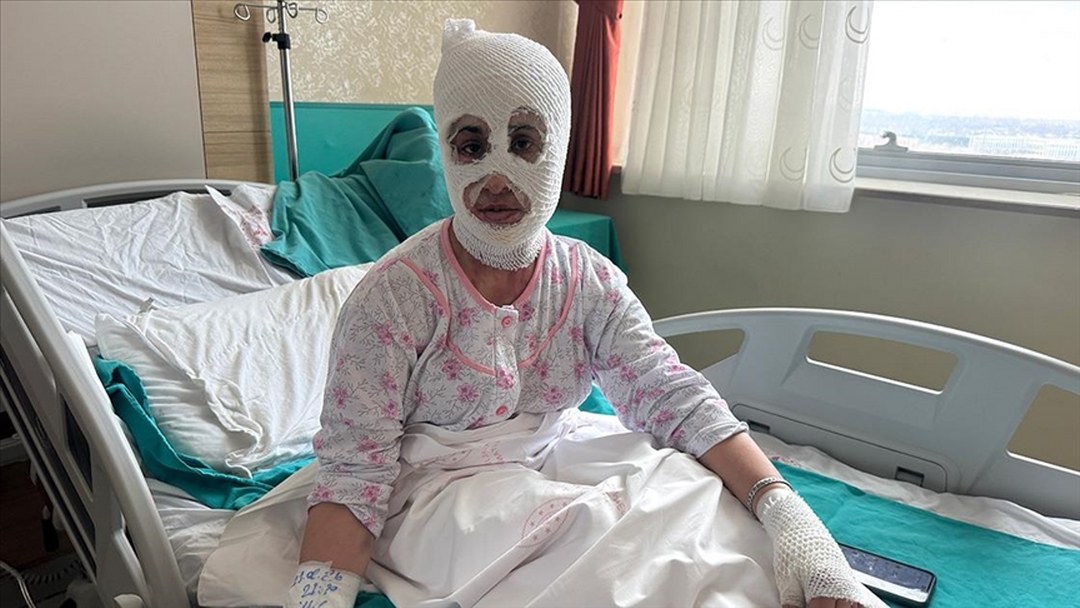 İftara hazırlık sırasında patlayan düdüklü tencere iki çocuk annesini hastanelik etti