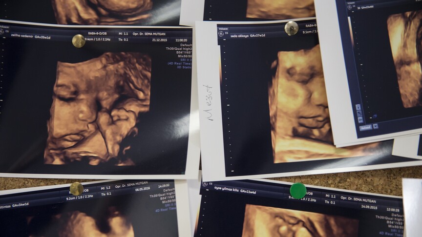 Annenin gençliğinde oluşan mutasyon bebeğinde hemofiliye yol açabiliyor