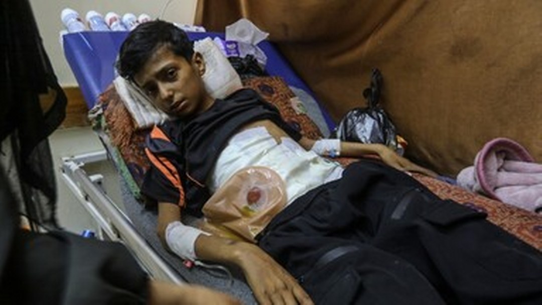 İsrail saldırısında ağır yaralanan 13 yaşındaki Ali, tedavi için Gazze’den tahliye edilmeyi bekliyor