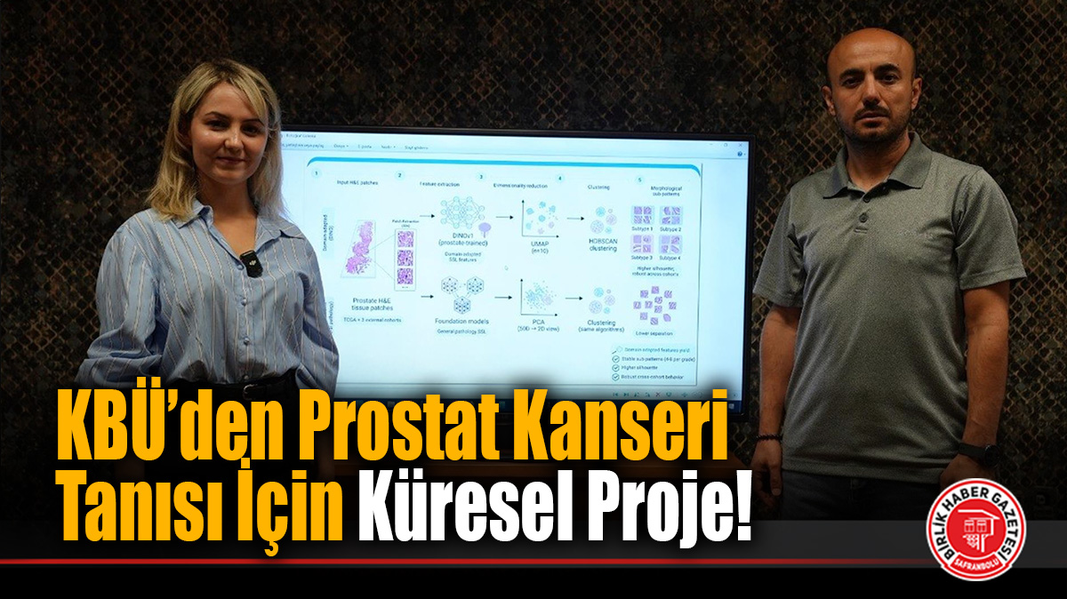 KBÜ’den Prostat Kanseri Tanısı İçin Küresel Proje!